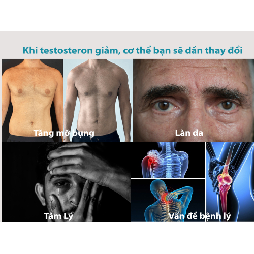 Biểu hiện của "giai đoạn mãn" ở nam giới không rõ ràng như phụ nữ.